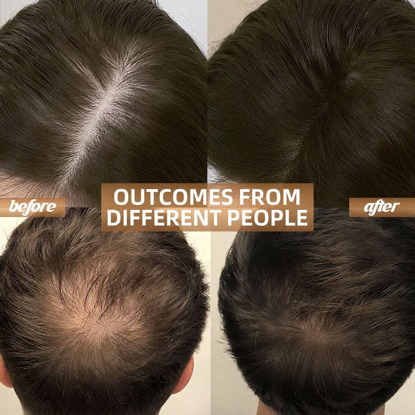 Cordless Red Light Therapy Cap For Hair Growth